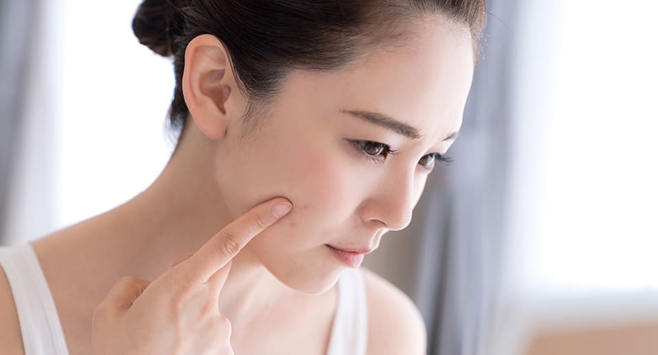 10 Masalah Kecantikan yang Umum dan Solusinya